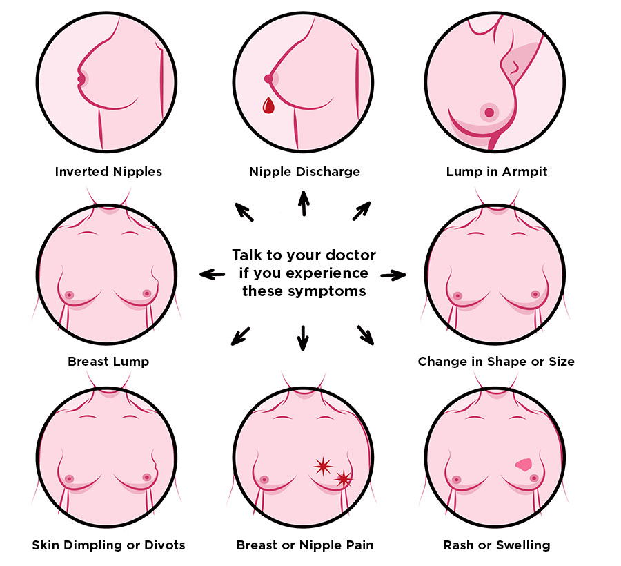 Laurel Health infographic demonstrating the types of breast symptoms you should talk to your doctor about. It highlights the following symptoms, nipple discharge, breast pain, swelling or changes to breast size and shape, rashes, skin dimpling, rashes, or divots, and lumps in breast tissue or armpit